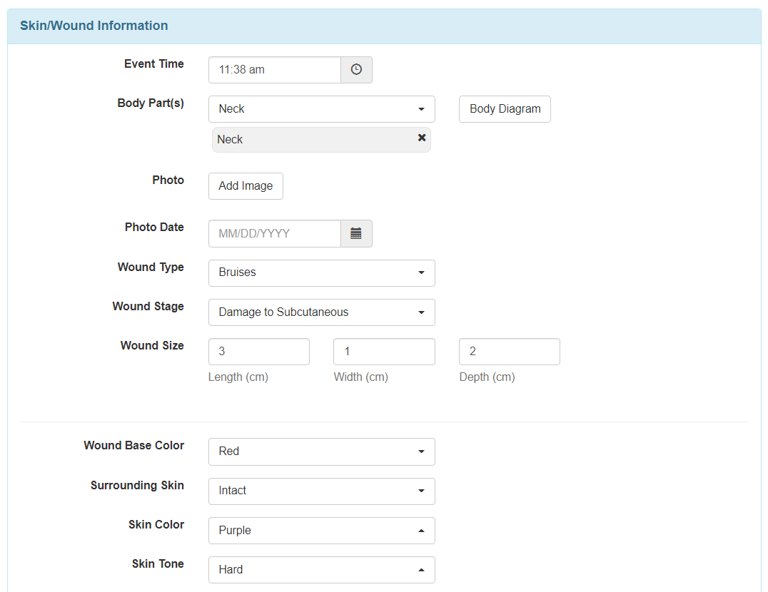 skinwound info johanna edit select program from isp program list