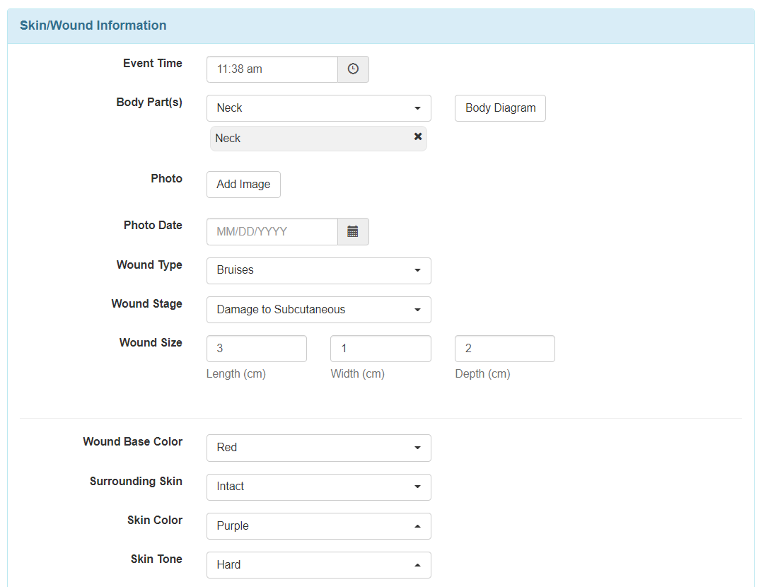 select program from isp program list